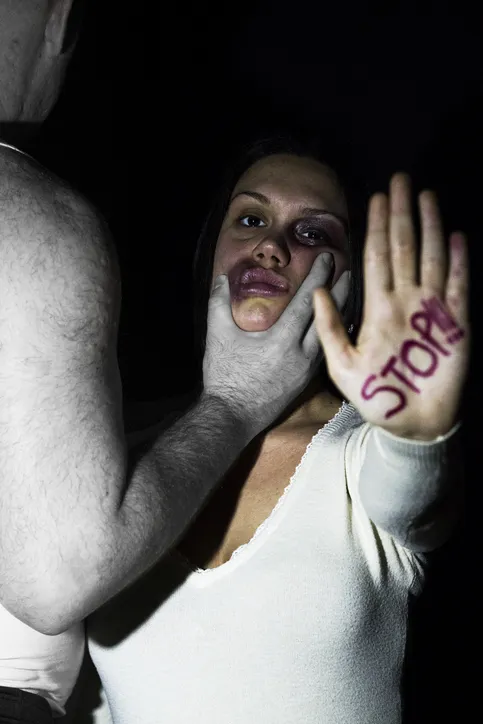 Mujer con signos de maltrato mostrando la palma de la mano con la palabra STOP, mientras un hombre le sujeta el rostro, representando la violencia de género